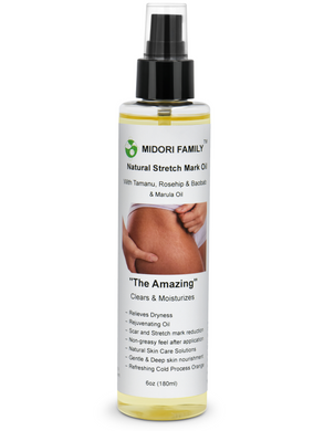 Botanical Stretch-mark oil- 6oz